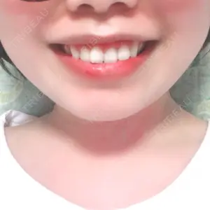 湘南美容歯科 横浜院口コミ