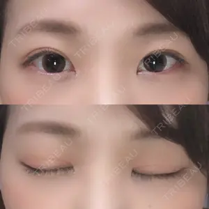 大阪梅田中央クリニック美容外科口コミ