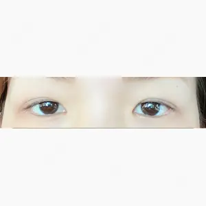 MIYAフェイスクリニック口コミ