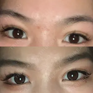 湘南美容クリニック 広島院口コミ