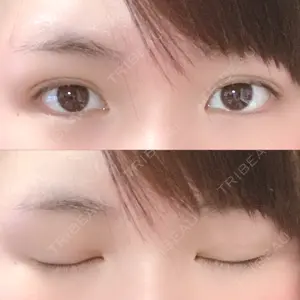 MIYAフェイスクリニック口コミ