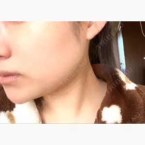 品川スキンクリニック岡山院口コミ