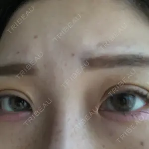 品川スキンクリニック広島院口コミ