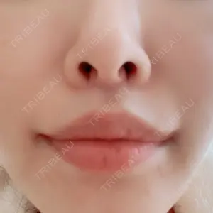 清潭女神美容外科口コミ