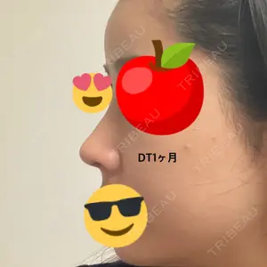 GIRIN（ギリン）美容外科口コミ