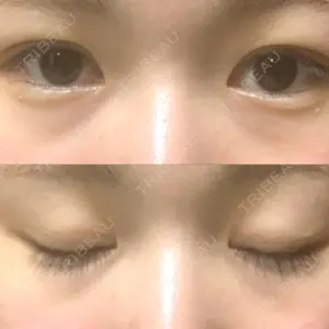 湘南美容クリニック 広島院口コミ