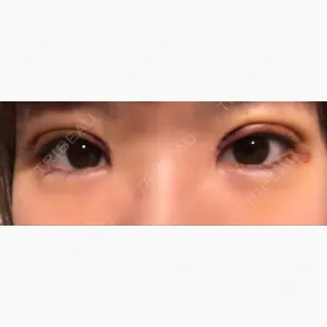 品川スキンクリニック 新潟院口コミ