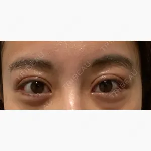 id（アイディ）美容外科口コミ
