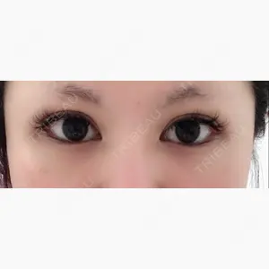 オペラ整形外科口コミ