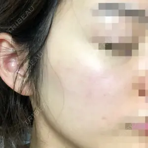 UB CLINIC銀座口コミ