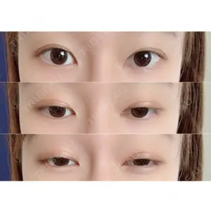 共立美容外科 柏院口コミ