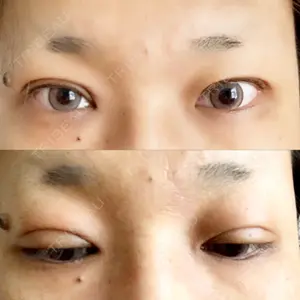 品川美容外科 大宮院口コミ