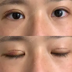 高須クリニック 横浜院口コミ