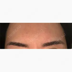 メディカルブロー 表参道院口コミ