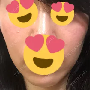 品川スキンクリニック京都院口コミ