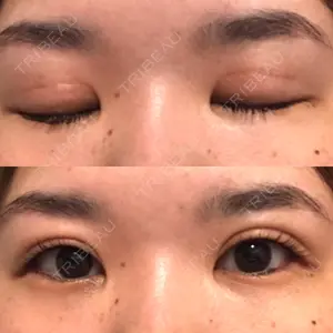 銀座高須クリニック口コミ