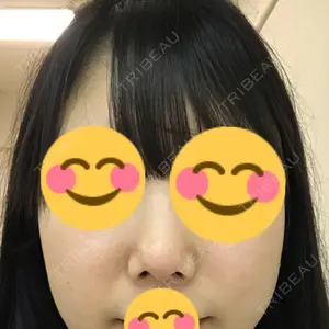 RG整形外科（旧リオン整形外科）口コミ