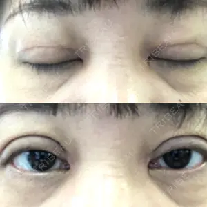 名古屋美容外科口コミ