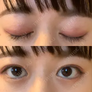 湘南美容クリニック 金沢院口コミ