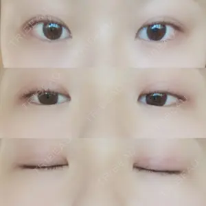 みやざき美容クリニック口コミ