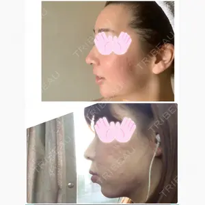 小倉IOI矯正歯科クリニック口コミ