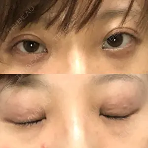 ティーズクリニック口コミ