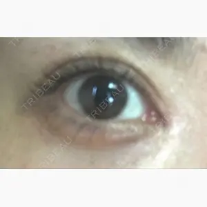 ジュエリー美容外科口コミ