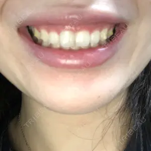 しらゆりデンタルクリニック口コミ