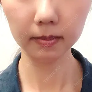 カトレア歯科・美容クリニック口コミ
