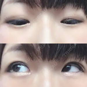湘南美容クリニック 池袋東口院口コミ