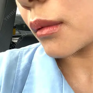 品川スキンクリニック 新潟院口コミ