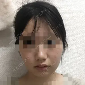 アサミ美容外科 大阪院口コミ