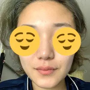 エートップ美容整形外科口コミ