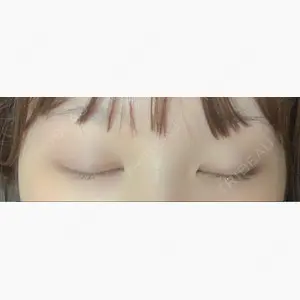 湘南美容クリニック 赤坂見附院口コミ