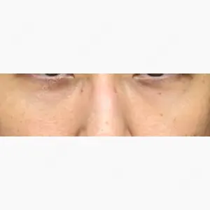 韓国ST美容整形外科口コミ