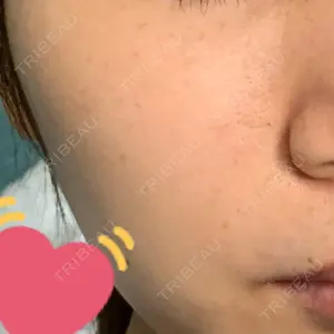 品川スキンクリニック梅田院口コミ