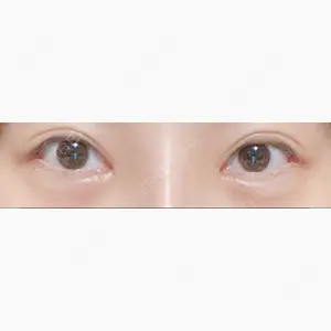 エイペックス美容外科口コミ