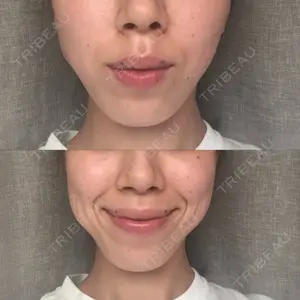 アルファクリニック新宿口コミ