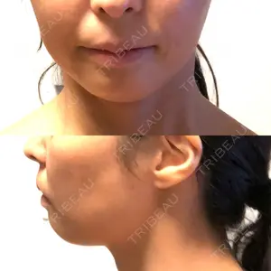 ティーズクリニック口コミ