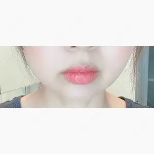 赤坂プレミアクリニック口コミ