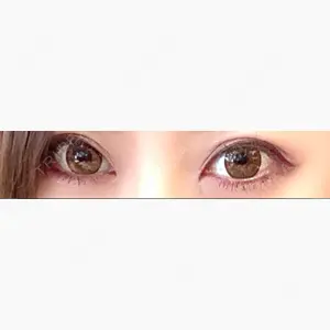 心斎橋コムロ美容外科クリニック口コミ