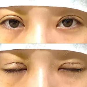 品川美容外科 大宮院口コミ