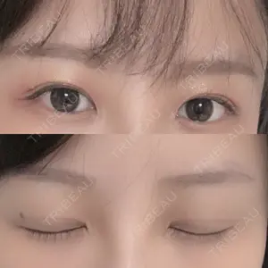 RG整形外科（旧リオン整形外科）口コミ