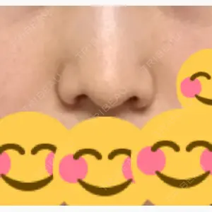 ツツイ美容外科口コミ