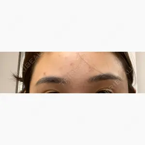 メディカルブロー 表参道院口コミ