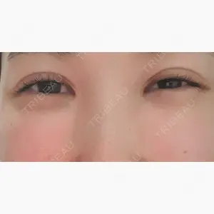 CLASSY 仙台美容外科・美容皮膚科口コミ