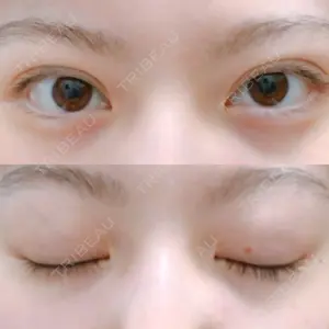 湘南美容クリニック 武蔵小杉院口コミ