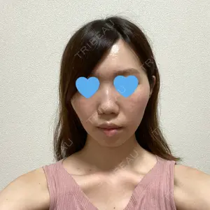 赤坂プレミアクリニック口コミ