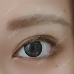 湘南美容クリニック 渋谷アネックス院口コミ