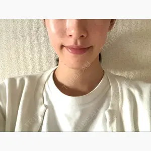 銀座フェイスクリニック（小顔整形・輪郭整形專門）口コミ